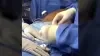 EASE OF USE – ERIC MALLICO, M.D. FACS video thumbnail