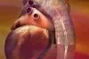 GORE TAG Thoracic Endoprosthesis