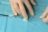 GORE Embolic Filter