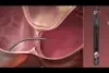 animation thumbnail