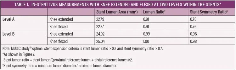 In Stent IVUS Measurements