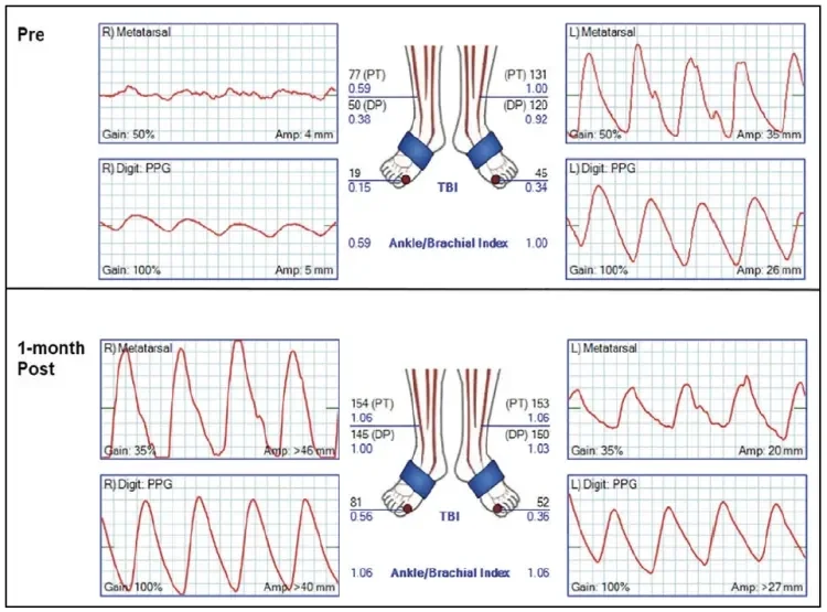 noninvasive assement