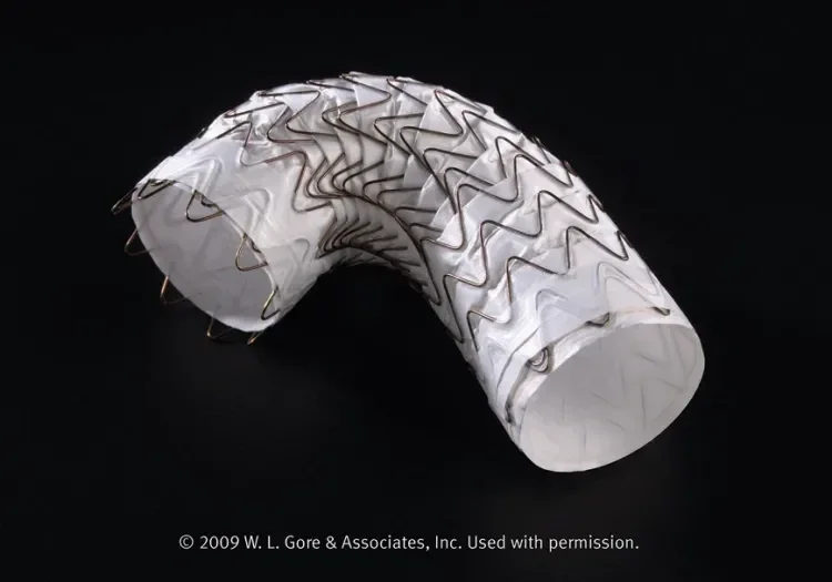 The Conformable GORE® TAG® Thoracic Endoprosthesis.