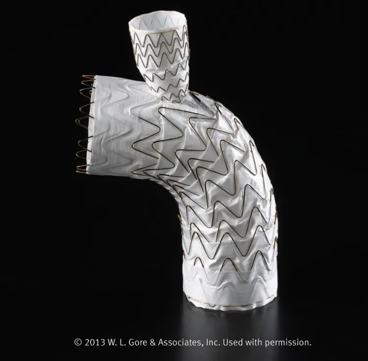 The GORE® TAG® Thoracic Branch Endoprosthesis