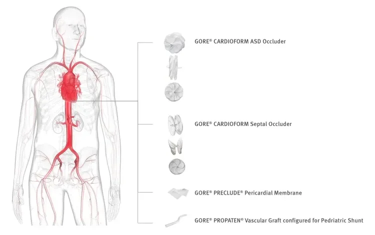 transparent man that illustrates where Gore Medical products are in the body