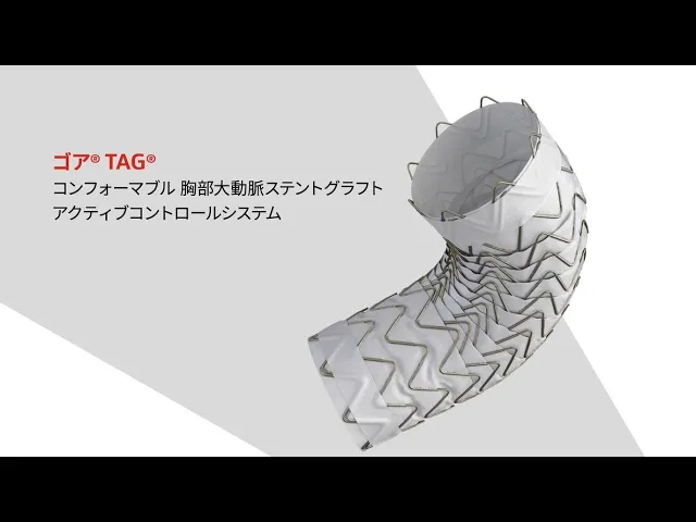 ゴア® TAG® コンフォーマブル 胸部大動脈ステントグラフト アクティブコントロールシステム製品紹介（30秒）