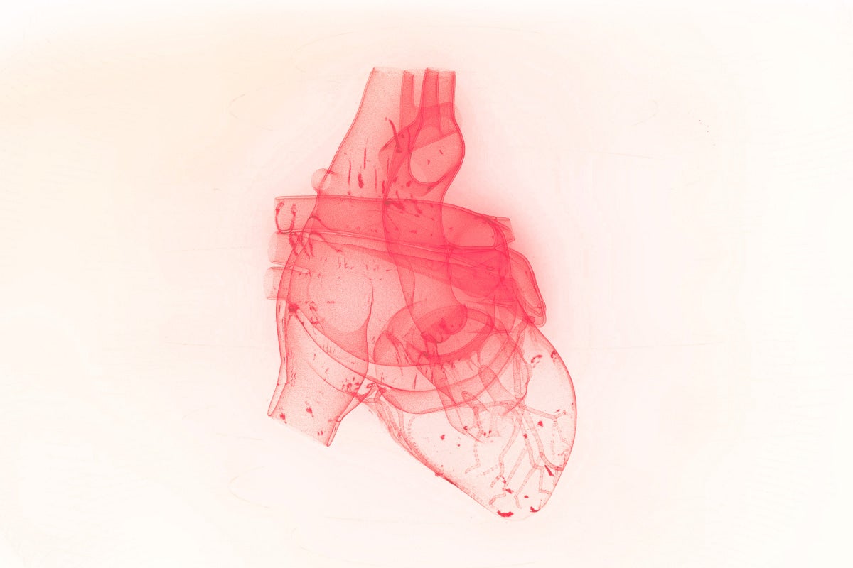 conditions-cardiac-heart-defect--2022-Q4--teaser