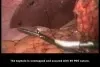 GORE BIO-A Tissue Reinforcement