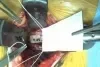 GORE PRECLUDE Vessel Guard 