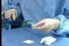 GORE SEAMGUARD Bioabsorbable Staple Line Reinforcement