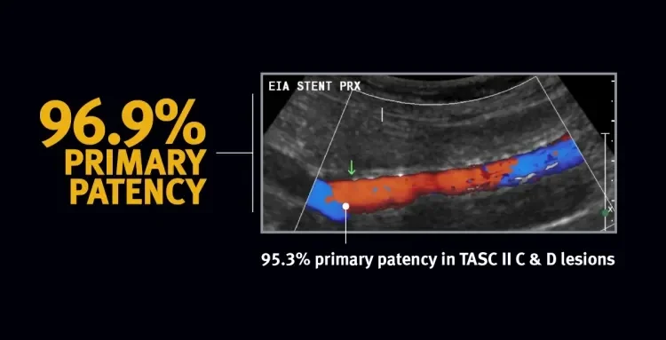 96.9% primary patency