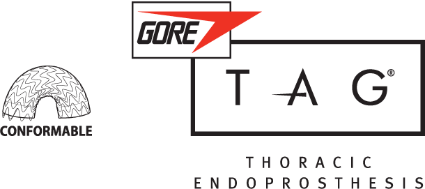 Conformable GORE TAG Thoracic Endoprosthesis