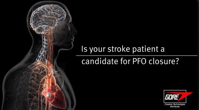 Is your stroke patient a candidate for PFO closure?