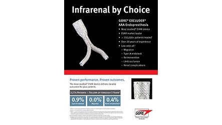 Infrarenal by Choice PDF Thumbnail