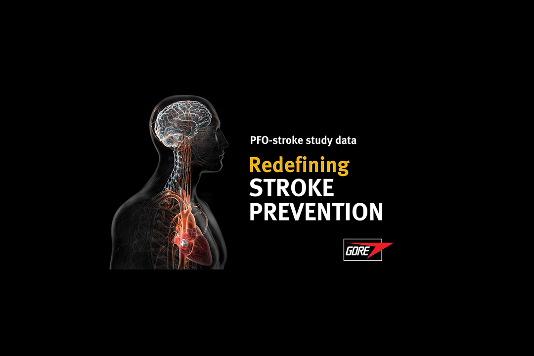 Reduce Study, Redefining Stroke Prevention