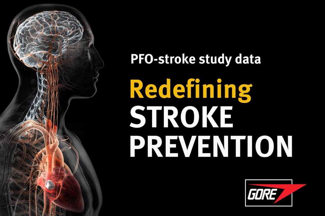 PFO stroke study data Redefining Stroke Prevention