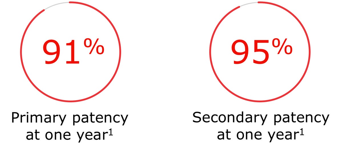 91% primary patency at one year and 95% secondary patency at one year