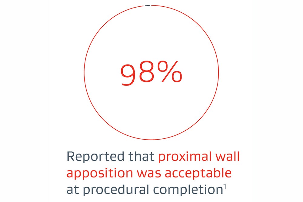 98% reported that the proximal wall apposition was acceptable at procedural completion1