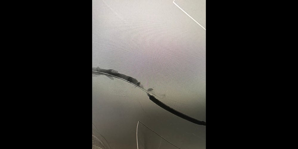 Angiogram