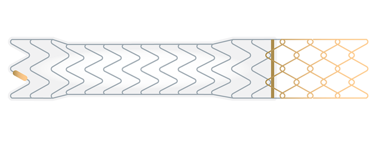 VIATORR® Device
