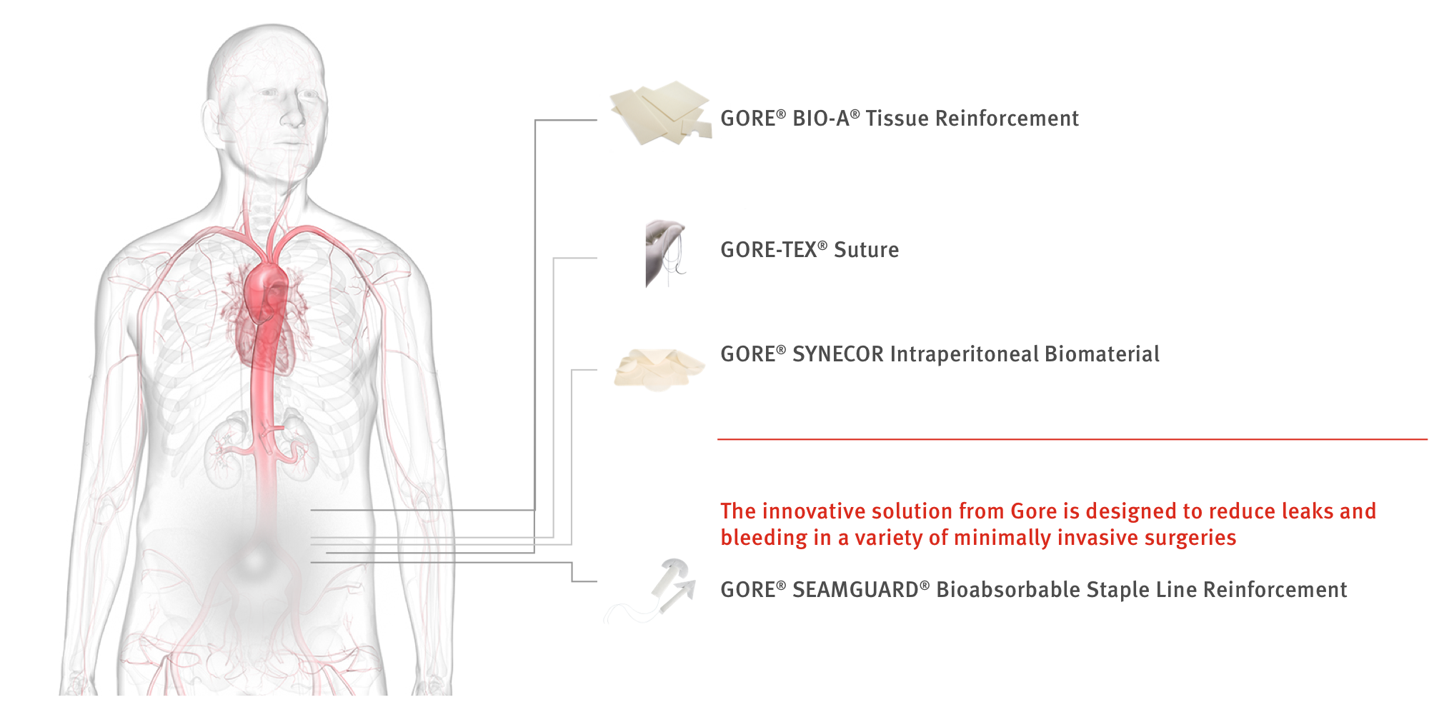 transparent man that illustrates where Gore Medical products are in the body