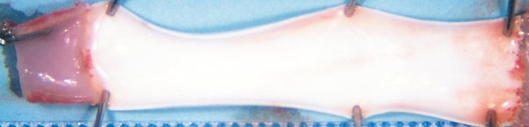 Benchtop GORE ROPATEN® Vascular Graft