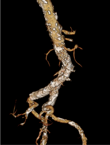 Twelve-month follow-up