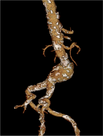 Pre-treatment