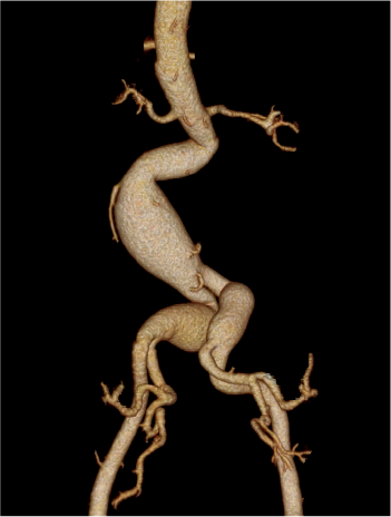 Pre-treatment