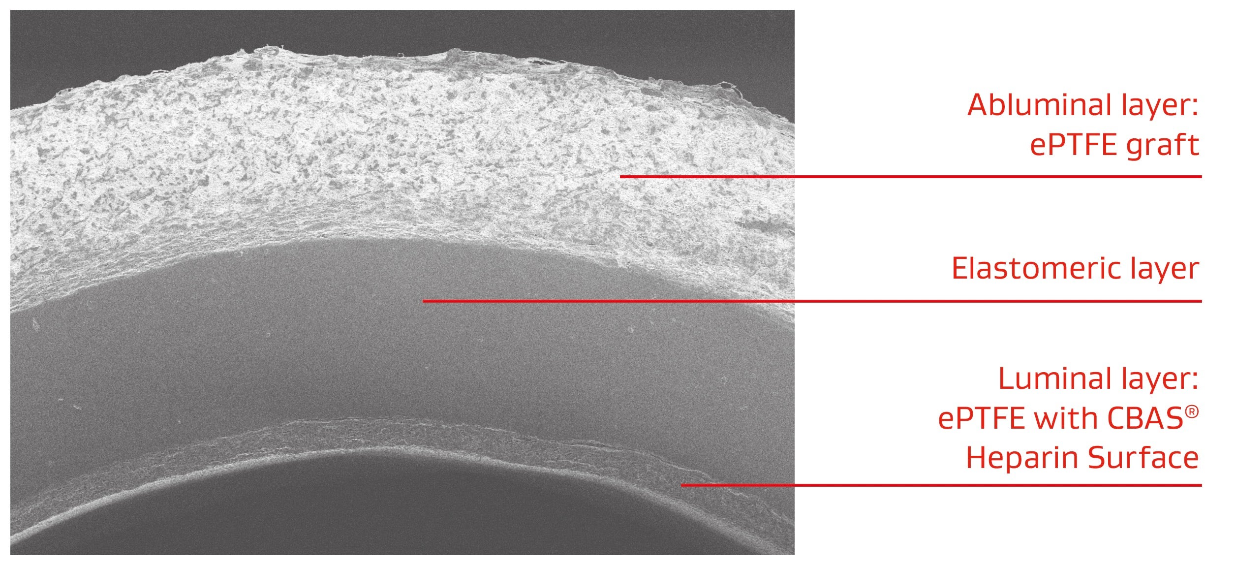 black and white image showing layers of material related to acuseal vascular graft