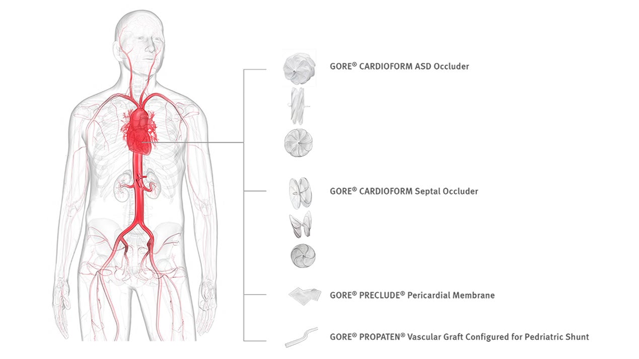 Cardiac medical devices