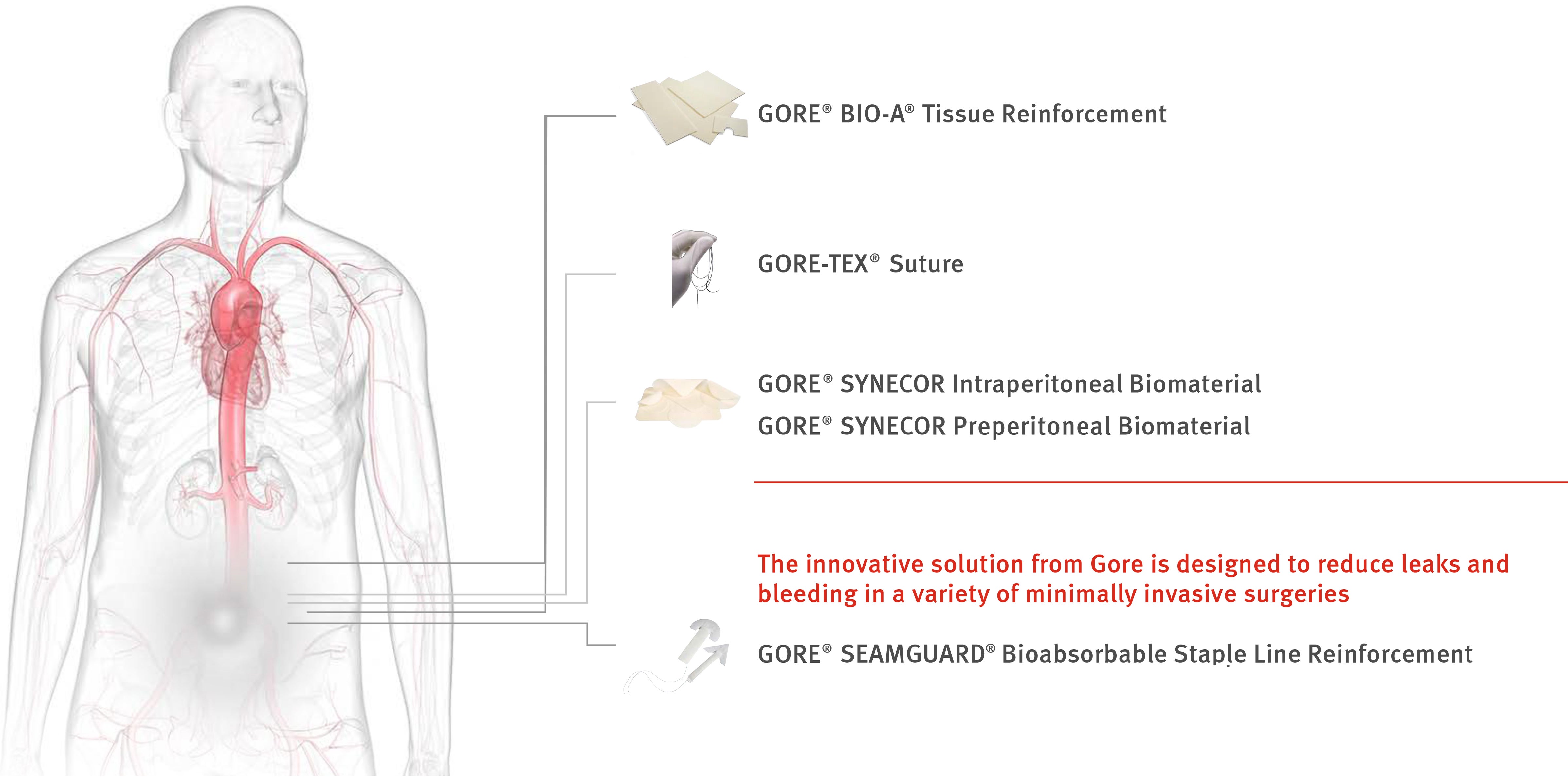 General surgery medical devices