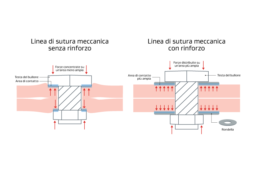 Illustrazione che confronta una linea di sutura meccanica senza rinforzo con una linea di sutura meccanica con rinforzo