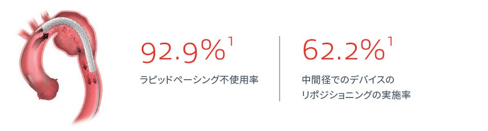 ゴア® TAG® コンフォーマブル 胸部大動脈ステントグラフト アクティブコントロールシステム 評価されたテクノロジー: 二段階展開方式