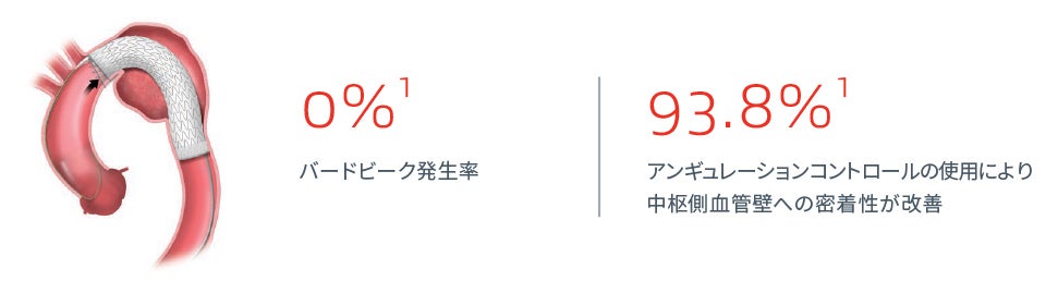 ゴア® TAG® コンフォーマブル 胸部大動脈ステントグラフト アクティブコントロールシステム 評価されたテクノロジー: 中枢端の角度調整機能