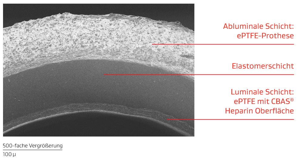 Abbildung zeigt Materialschichten im Zusammenhang mit der ACUSEAL Gefäßprothese