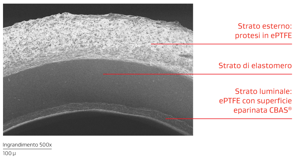 Immagine che mostra gli strati di materiale correlati alla protesi vascolare ACUSEAL