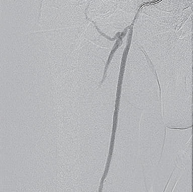 図8 大腿部・術後
