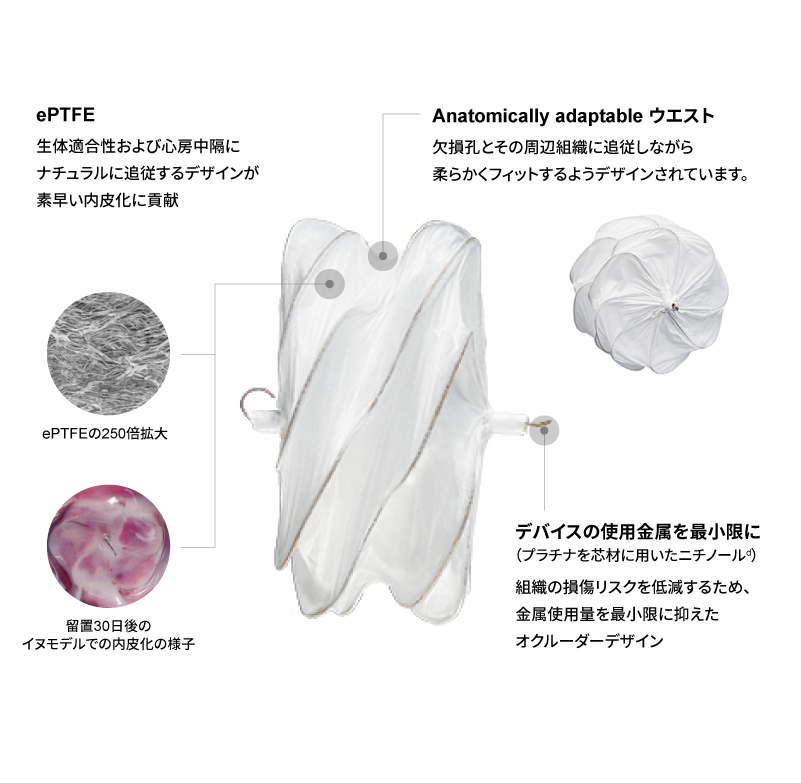 カーディオフォーム ASDオクルーダー 概要説明