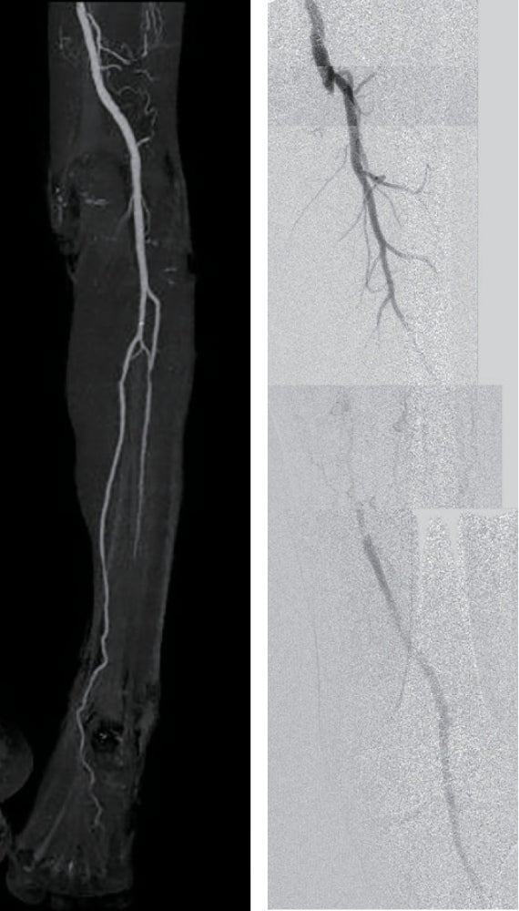 図1- 術前 左・右
