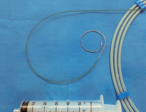 図1：ガイドワイヤー manipulation  前