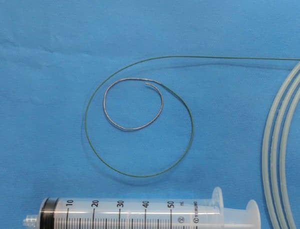 図2：ガイドワイヤー manipulation 後