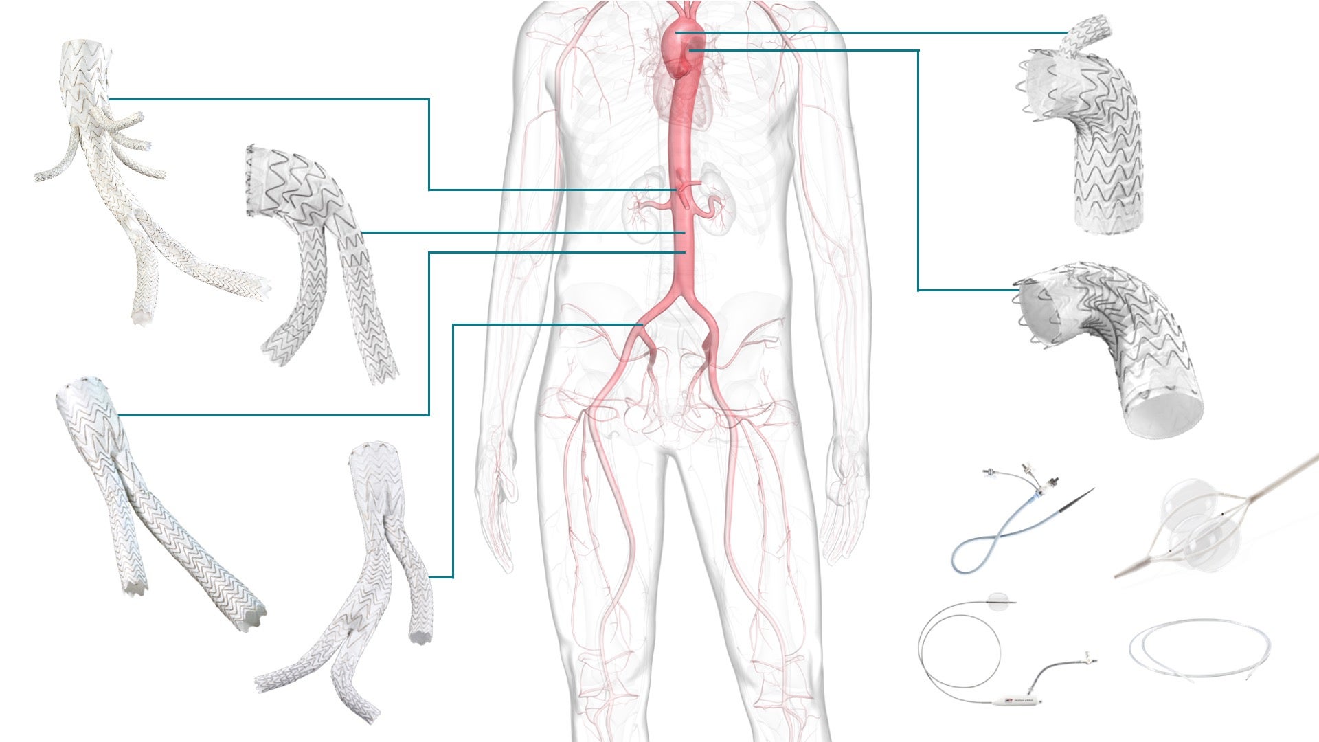 Illustration of the human body highlighting aortic treatment areas and related products