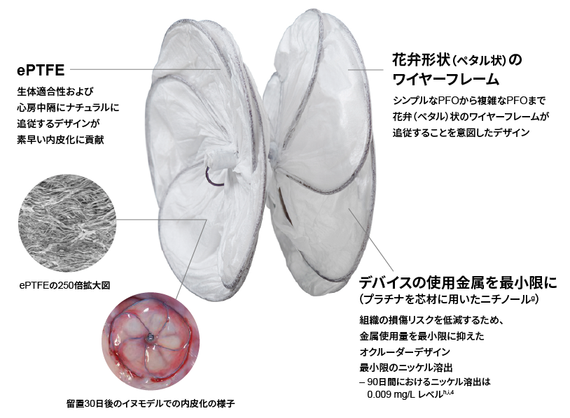 カーディオフォーム セプタルオクルーダー 概要説明