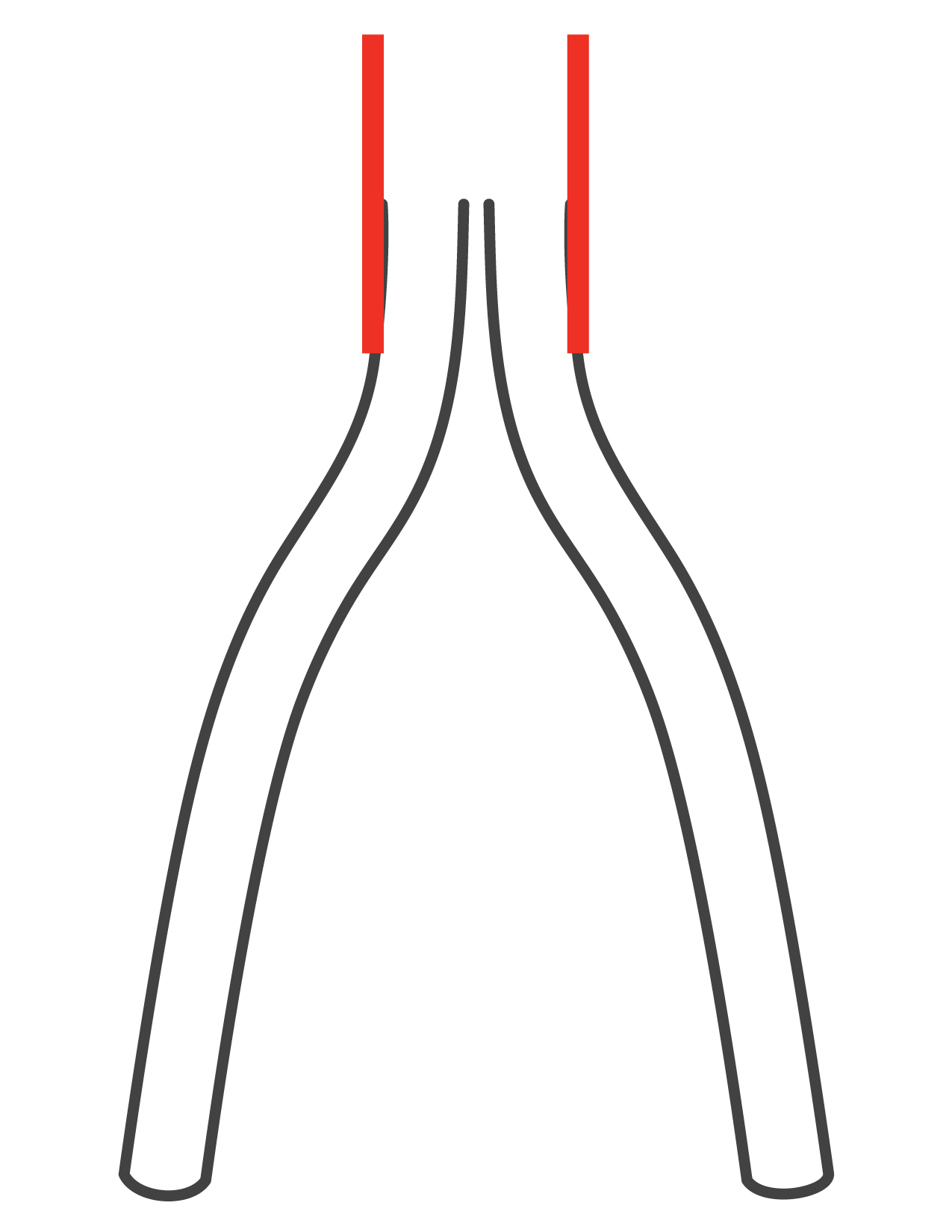 IVC + bilateral iliofemoral confluence