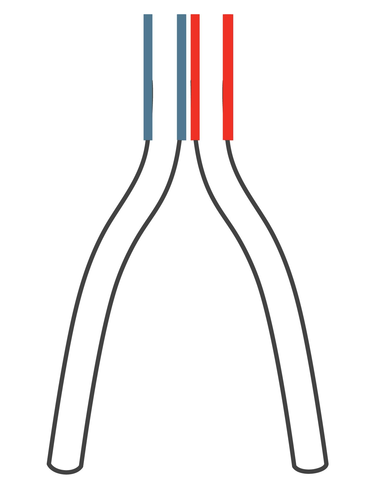 IVC + bilateral iliofemoral double-barrel