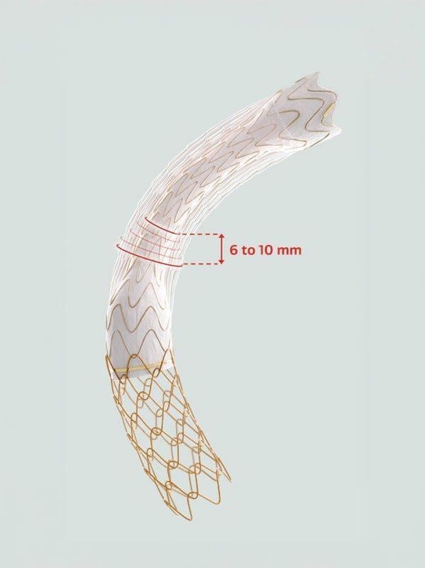 Illustration of a curved covered stent graft with an uncovered metal mesh extension at one end. A red measurement callout highlights a 6 to 10 mm section along the graft, indicating the adjustable dilatation range.