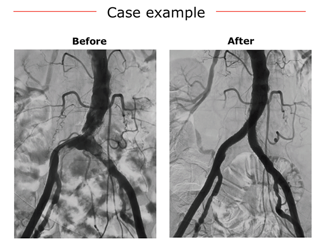 Case examples