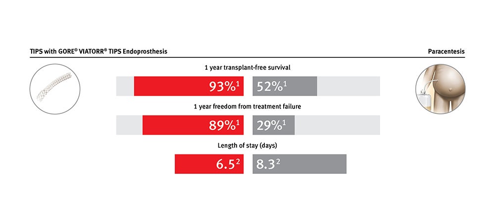 Chart showing improved transplant-free survival and control of ascites compared to repeat paracentesis procedures