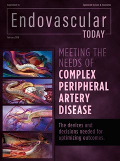Endovascular Today February 2017 Supplement